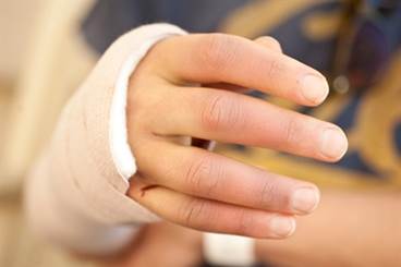 Wrist Pain After A Fall: More Than A Simple Fracture Wrist Pain After A Fall: More Than A Simple Fracture