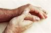 FDA Approves Duzallo, Lesinurad Plus Allopurinol Combo Drug, for Gout FDA Approves Duzallo, Lesinurad Plus Allopurinol Combo Drug, for Gout