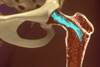 Stem Cell Therapy for Pain Management Stem Cell Therapy for Pain Management