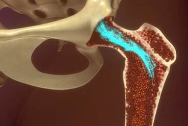 Stem Cell Therapy for Pain Management Stem Cell Therapy for Pain Management