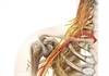 Low-Dose Perineural Dexamethasone Prolongs Effects of Brachial Plexus Nerve Block Low-Dose Perineural Dexamethasone Prolongs Effects of Brachial Plexus Nerve Block