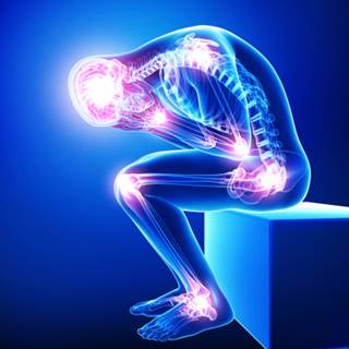 X-ray Unlocking Mechanics of Pain Relief X-ray Unlocking Mechanics of Pain Relief