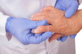 Neuropathic Pain Often a Factor in Rheumatoid Arthritis Neuropathic Pain Often a Factor in Rheumatoid Arthritis