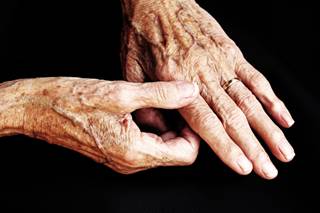 A treat-to-target approach yielded greater psoriatic arthritis symptom improvement. A treat-to-target approach yielded greater psoriatic arthritis symptom improvement.