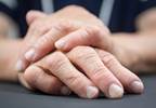 Lower Rheumatoid Arthritis Activity Seen at Practices with NPs, PAs Lower Rheumatoid Arthritis Activity Seen at Practices with NPs, PAs