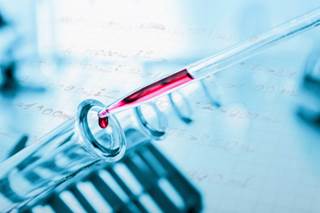 Genetics Could Play Role With Aspirin, NSAIDs, and CRC Risk Genetics Could Play Role With Aspirin, NSAIDs, and CRC Risk