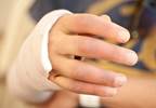 Wrist Pain After A Fall: More Than A Simple Fracture Wrist Pain After A Fall: More Than A Simple Fracture