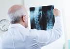 MAPCs Reduce Immune System Damage After Spinal Cord Injury MAPCs Reduce Immune System Damage After Spinal Cord Injury