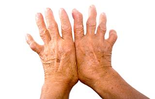 The use of opioid analgesics may increase the risk of serious infection in patients with RA. The use of opioid analgesics may increase the risk of serious infection in patients with RA.