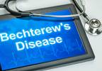 Ankylosing Spondylitis: New Guidelines Developed for Treatment Ankylosing Spondylitis: New Guidelines Developed for Treatment