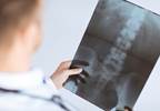 Multimodal Pain Management Increasingly Used for Patients Undergoing TKA and THA Multimodal Pain Management Increasingly Used for Patients Undergoing TKA and THA