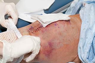 TXA according to research presented at the American Academy of Orthopaedic Surgeons (AAOS) 2016 Annual Meeting in Orlando, Florida. TXA according to research presented at the American Academy of Orthopaedic Surgeons (AAOS) 2016 Annual Meeting in Orlando, Florida.