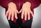 PTSD Symptomatology Associated With Increased Risk of RA PTSD Symptomatology Associated With Increased Risk of RA