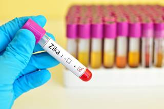 The list of neurological disorders potentially associated with the Zika virus continues to grow, according to a letter to the editor and a perspective piece published online in the New England Journal The list of neurological disorders potentially associated with the Zika virus continues to grow, according to a letter to the editor and a perspective piece published online in the New England Journal