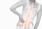 Establishing a Spine Patient Registry Establishing a Spine Patient Registry