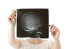 Pediatric Isolated Skull Fractures May Not Require Overnight Hospitalization Pediatric Isolated Skull Fractures May Not Require Overnight Hospitalization