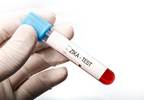 CDC Hosts Zika Action Plan Summit CDC Hosts Zika Action Plan Summit