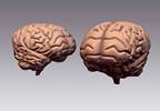 Brain Plasticity in Patients With Complex Regional Pain Syndrome Brain Plasticity in Patients With Complex Regional Pain Syndrome