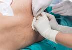 Interventional Treatments of Cancer Pain are Effective but Under-Utilized Interventional Treatments of Cancer Pain are Effective but Under-Utilized