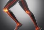 Rheumatoid Arthritis: Different Mechanisms for Different Joints Rheumatoid Arthritis: Different Mechanisms for Different Joints