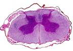 Targeting Microglia Activation to Treat Neuropathic Pain Following Spinal Cord Injury Targeting Microglia Activation to Treat Neuropathic Pain Following Spinal Cord Injury