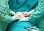 Effect of Ropivacaine on Opioid Consumption, Pain Following Hysterectomy Effect of Ropivacaine on Opioid Consumption, Pain Following Hysterectomy