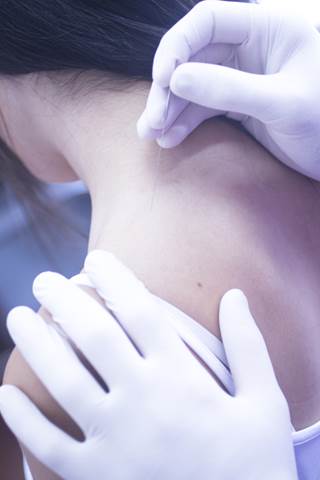 Parkinson's patients receiving electro-acupuncture treatment had improved balance. Parkinson's patients receiving electro-acupuncture treatment had improved balance.