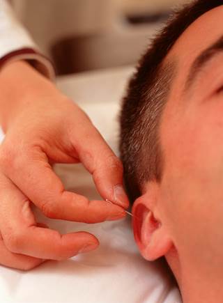 Auricular acupuncture is effective for treatment of TBI-related headaches. Auricular acupuncture is effective for treatment of TBI-related headaches.