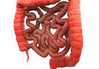 Appendicitis Should Be Considered Among Elderly Appendicitis Should Be Considered Among Elderly