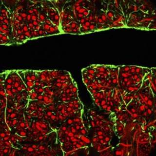 Dissociating dopamine-mediated euphoria and analgesia by slowing the rate of entry of opioid-like compounds through the blood-brain barrier. Dissociating dopamine-mediated euphoria and analgesia by slowing the rate of entry of opioid-like compounds through the blood-brain barrier.