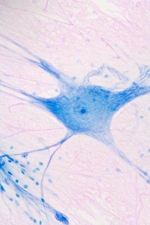 Microglia are involved in opioid-induced hyperalgesia. Microglia are involved in opioid-induced hyperalgesia.