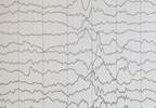 Neurofeedback for Neuropathic Pain Neurofeedback for Neuropathic Pain