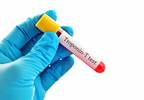 Modest Changes in Practice for High-Sensitivity TnT Reporting Modest Changes in Practice for High-Sensitivity TnT Reporting