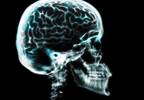 Brain or Body: Which Treatments Work Best for Patients With Pain? Brain or Body: Which Treatments Work Best for Patients With Pain?