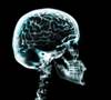 Brain or Body: Which Treatments Work Best for Patients With Pain? Brain or Body: Which Treatments Work Best for Patients With Pain?