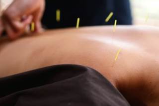 Due to the scarcity of effective treatments for pain in fibromyalgia, up to 20% of patients seek alternative therapies such as acupuncture. Due to the scarcity of effective treatments for pain in fibromyalgia, up to 20% of patients seek alternative therapies such as acupuncture.