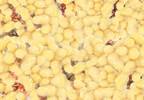 Obesity and Arthritis Outcomes Obesity and Arthritis Outcomes