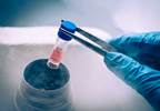 Liberalizing Access to Biobanks to Benefit Genomic Research Liberalizing Access to Biobanks to Benefit Genomic Research