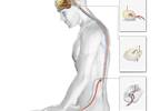 Psychophysical Responses in Acupuncture vs Sham Laser Psychophysical Responses in Acupuncture vs Sham Laser