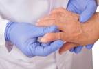 Establishing Thresholds for Patient and Clinician-Based RA Disease Activity Scores Establishing Thresholds for Patient and Clinician-Based RA Disease Activity Scores