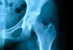 Diagnosing and Treating Hip Pain: Q&A With a Sports Medicine Orthopedic Surgeon Diagnosing and Treating Hip Pain: Q&A With a Sports Medicine Orthopedic Surgeon