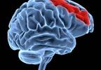 Predicting Placebo Response? It May Now be Possible Predicting Placebo Response? It May Now be Possible
