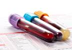 Predicting Arthritis Progression in Patients With Arthralgia Predicting Arthritis Progression in Patients With Arthralgia