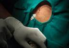 Biomarkers of Neuronal Damage in Repetitive Mild TBI Identified Biomarkers of Neuronal Damage in Repetitive Mild TBI Identified