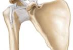 Reducing Cardiovascular Disease Risk to Prevent Shoulder Tendinitis Reducing Cardiovascular Disease Risk to Prevent Shoulder Tendinitis