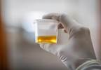 What Do Clinicians Do in Response to Aberrant Urine Drug Test Results? What Do Clinicians Do in Response to Aberrant Urine Drug Test Results?
