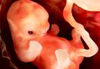 Preventing and Managing Neonatal Abstinence Syndrome Preventing and Managing Neonatal Abstinence Syndrome