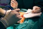 Thoracic Paravertebral Nerve Block for Postthoracotomy Pain Thoracic Paravertebral Nerve Block for Postthoracotomy Pain