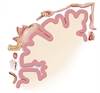 Allodynia May Affect Treatment Response to Acute Migraine Allodynia May Affect Treatment Response to Acute Migraine