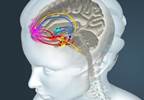 A Link Between Altered Reward Processing and Later Pain Complaints? A Link Between Altered Reward Processing and Later Pain Complaints?